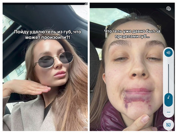 Зображення