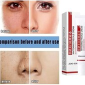 ! Оригинал ! Отбеливающий крем для лица Zoo Son whitening freckle Cream арт21